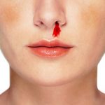 sognare sangue dal naso